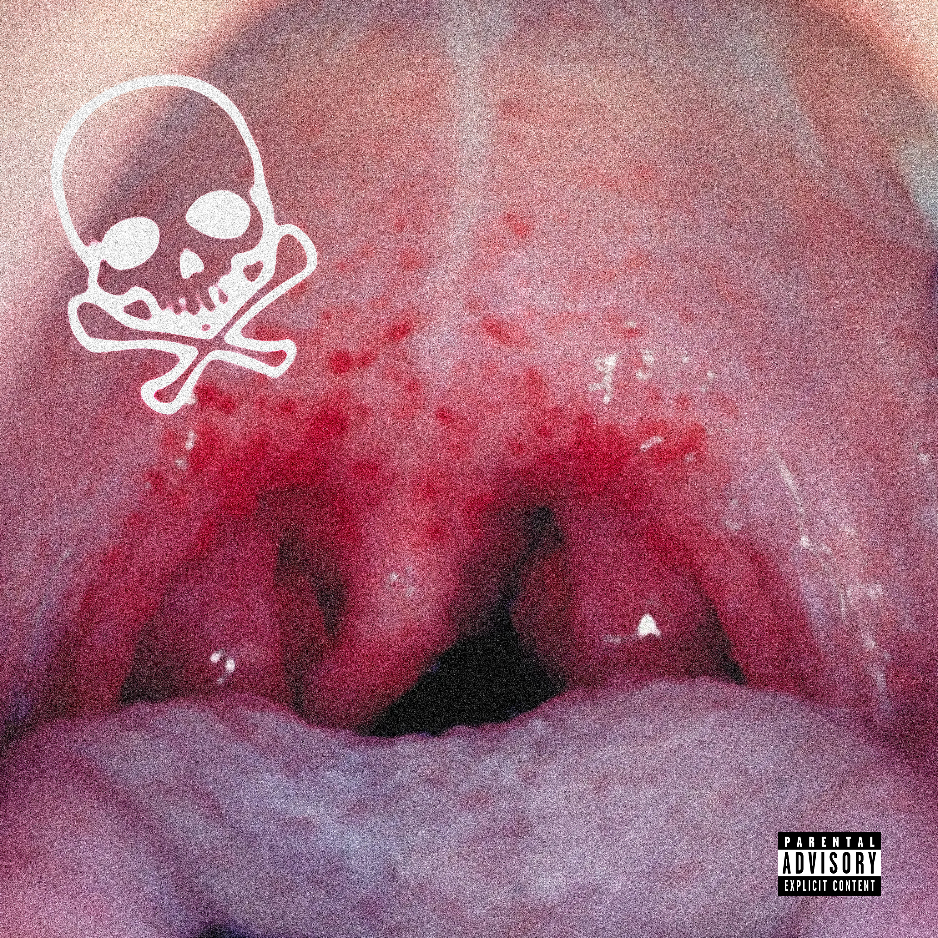 sore throat (demo)